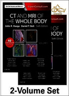CT and MRI of the Whole Body, 2-Volume Set ELSEVIER ELSEVIER