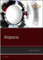 Alopecia ELSEVIER ELSEVIER
