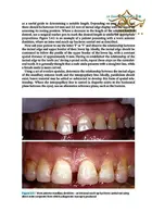 Practical Procedures in Aesthetic Dentistry John Wiley-Sons