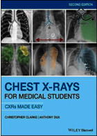 Chest X-Rays for Medical Students: CXRs Made Easy 2nd Edition2020  John Wiley and Sons Ltd   John Wiley and Sons Ltd 