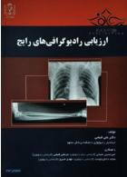 ارزیابی رادیوگرافی های رایج دانشگاه علوم پزشکی مشهد دانشگاه علوم پزشکی مشهد