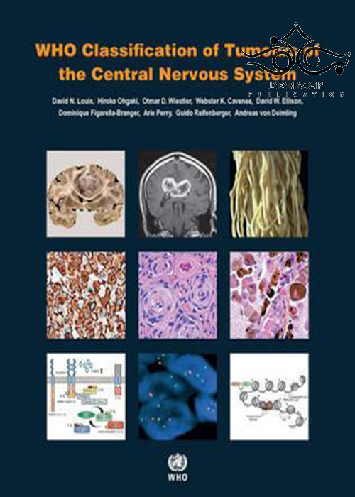 Classification of Tumours of the Central Nervous System, 4th Edition2016 WHO طبقه بندی تومورهای سیستم عصبی مرکزی