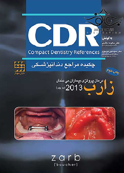 CDR چکیده مراجع دندانپزشکی درمان پروتزی بیماران بی دندان زارب بوچر 2013