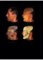 Dermal Fillers for Facial Harmony 1st Edition2019  Quintessence Publishing Co Inc.,U.S