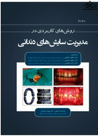 روش های کاربردی در مدیریت سایش های دندانی 2020 رویان پژوه رویان پژوه