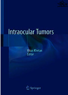 Intraocular Tumorsتومورهای داخل چشمی Springer Springer