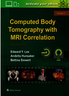 Computed Body Tomography with MRI Correlation Lippincott Williams Lippincott Williams