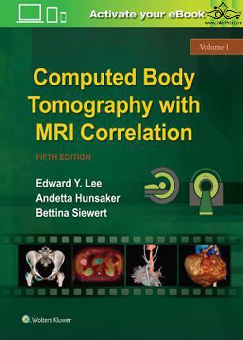 Computed Body Tomography with MRI Correlation
