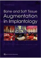 Bone and Soft Tissue Augmentation in Implantology 2022  Quintessence Publishing Co Inc.,U.S  Quintessence Publishing Co Inc.,U.S