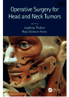 Operative Surgery for Head and Neck Tumors Taylor & Francis Ltd Taylor & Francis Ltd