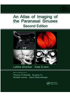 Atlas of Imaging of the Paranasal Sinuses, Second Edition Taylor & Francis Ltd