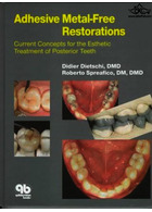 Adhesive Metal-Free Restorations : Current Concepts in the Aesthetic Treatment of Posterior Teeth  Quintessence Publishing Co Inc.,U.S  Quintessence Publishing Co Inc.,U.S