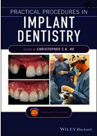 Practical Procedures in Implant Dentistry  John Wiley and Sons Ltd   John Wiley and Sons Ltd 