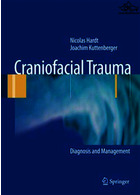 Craniofacial Trauma Springer