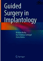 Guided Surgery in Implantology Springer Springer