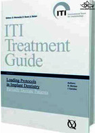 ITI Treatment Guide: Loading Protocols in Implant Dentistry - Partially Dentate Patients v. 2 Quintessenz Verlags GmbH Quintessenz Verlags GmbH