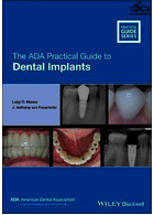 The ADA Practical Guide to Dental Implants 2021  John Wiley and Sons Ltd 