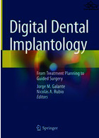 Digital Dental Implantology Springer
