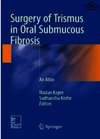 Surgery of Trismus in Oral Submucous Fibrosis Springer