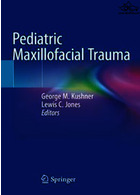 Pediatric Maxillofacial Trauma Springer