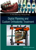 Digital Planning and Custom Orthodontic Treatment  John Wiley and Sons Ltd   John Wiley and Sons Ltd 