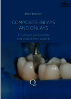 Composite Inlays and Onlays : Structural, Periodontal, and Endodontic Aspects  Quintessence Publishing Co Inc.,U.S