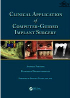 Clinical Application of Computer-Guided Implant Surgery Apple Academic Press Inc