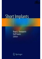 Short Implants Springer