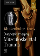 Diagnostic Imaging: Musculoskeletal Trauma 3rd Edición ELSEVIER ELSEVIER