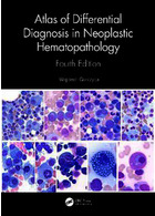 Atlas of Differential Diagnosis in Neoplastic Hematopathology 4th Edición Taylor & Francis Ltd