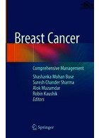 Breast Cancer: Comprehensive Management 1st ed. 2022 Edición Springer