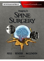 Imaging in Spine Surgery 1st Edición ELSEVIER ELSEVIER