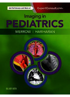 Imaging in Pediatrics E-Book 1st Edición ELSEVIER