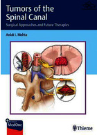 Tumors of the Spinal Canal: Surgical Approaches and Future Therapies 1st Edición Thieme