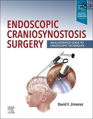 Endoscopic Craniosynostosis Surgery : An Illustrated Guide to Endoscopic Techniques