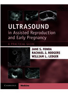 Ultrasound in Assisted Reproduction and Early Pregnancy: A Practical Guide 1st Edición Cambridge University Press