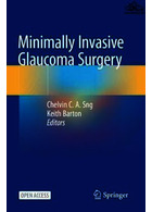 Minimally Invasive Glaucoma Surgery 1st ed Springer Springer