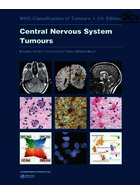 Central Nervous System Tumours (WHO Classification of Tumours) 5th Edición  Iarc   Iarc 