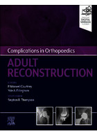 Complications in Orthopaedics: Adult Reconstruction 1st Edición ELSEVIER