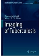 Imaging of Tuberculosis Springer Springer