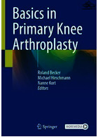 Basics in Primary Knee Arthroplasty Springer Springer