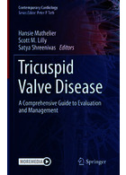 Tricuspid Valve Disease: A Comprehensive Guide to Evaluation and Management (Contemporary Cardiology) 1st ed. 2022 Edition Springer Springer