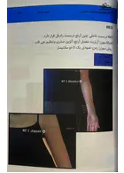 اولین مرجع طب سوزنی بدن 2022 پارسیان