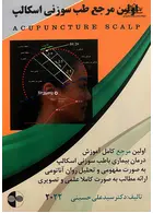 اولین مرجع طب سوزنی اسکالپ 2022 پارسیان