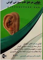 اولین مرجع طب سوزنی گوش 2022 پارسیان