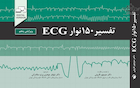 تفسیر 150 نوار ECG ویرایش پنجم
