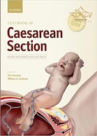 Textbook of Caesarean Section