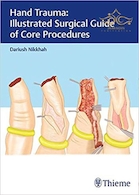 Hand Trauma: Illustrated Surgical Guide of Core Procedures