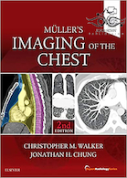 Muller’s Imaging of the Chest, 2nd Edition2018 | تصویربرداری مولر از قفسه سینه