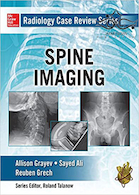 Radiology Case Review Series: Spine2015 مجموعه بررسی موارد رادیولوژی: ستون فقرات